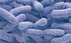 Alerta roja: bacterias resistentes